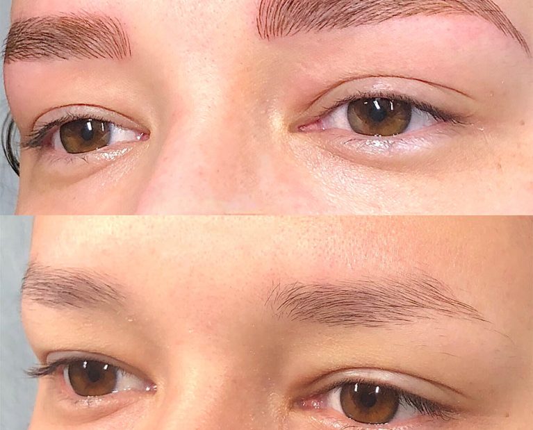 Microblading